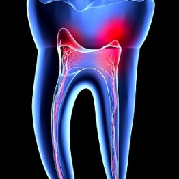 endodontia