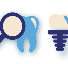 Implantes dentários ou dentaduras
