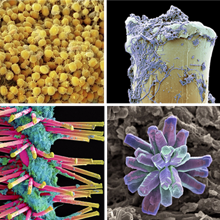 Imagens microscópicas de dente